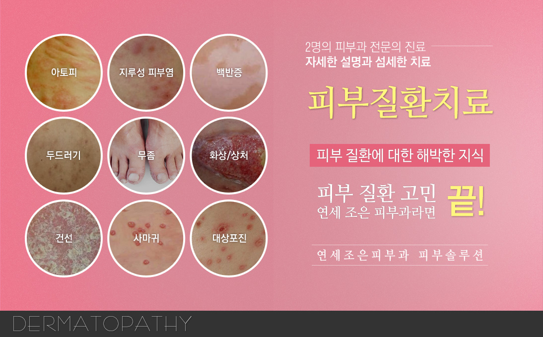 피부질환치료
