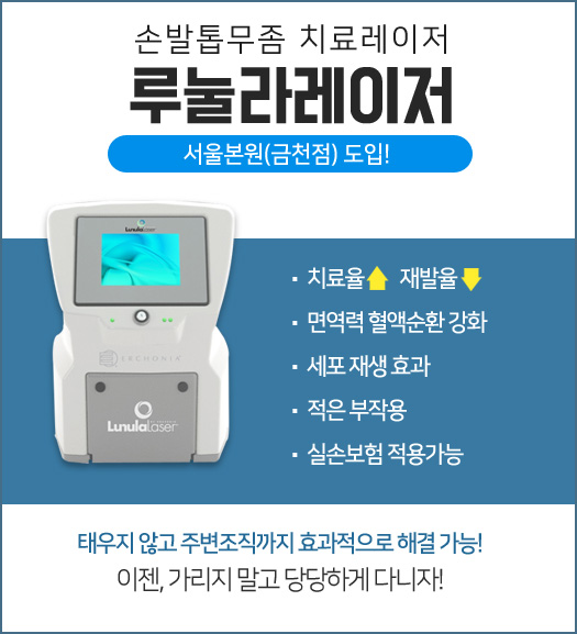 루눌라레이저